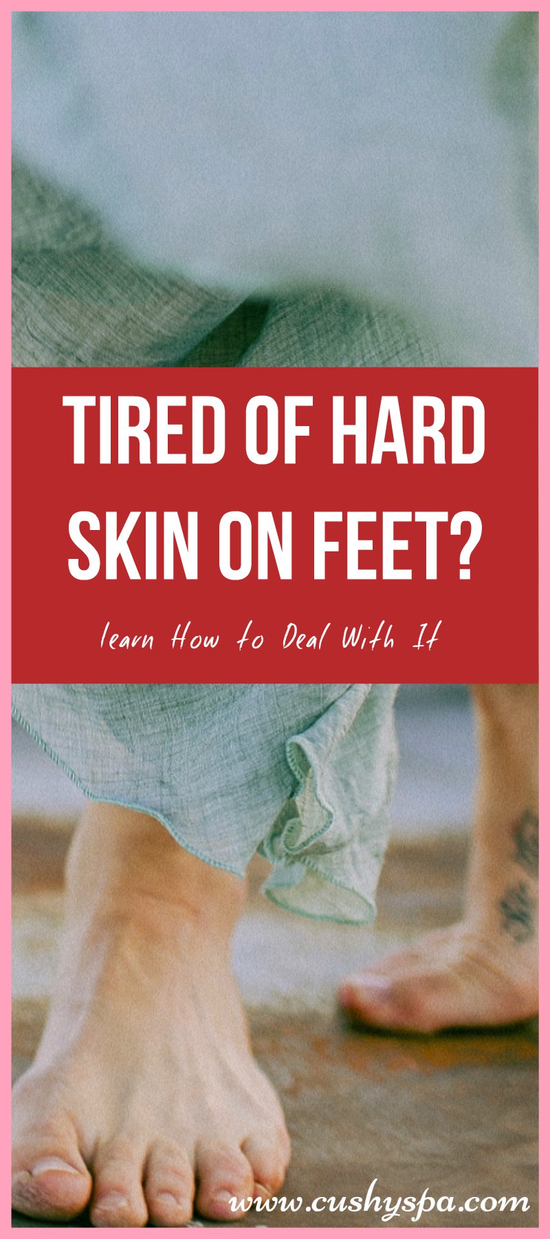 How To Get Rid Of Hard Skin Around Toes