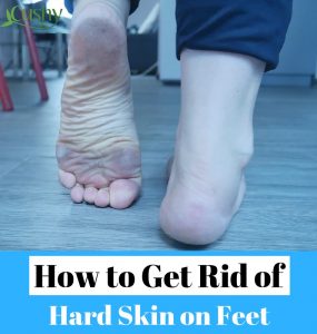 How To Get Rid Of Dead Skin On Feet: Step By Step Guide - Cushy Spa